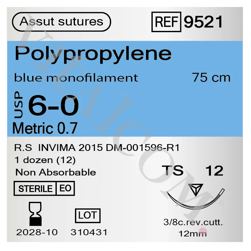 9521Frontal.webp